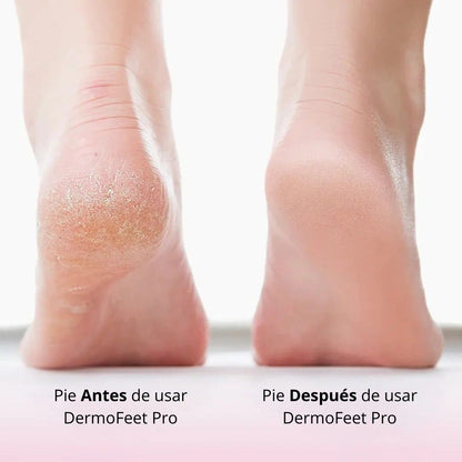 DermoFeet PRO - Pies suaves y sin callos en minutos!