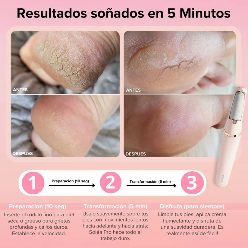 DermoFeet PRO - Pies suaves y sin callos en minutos!